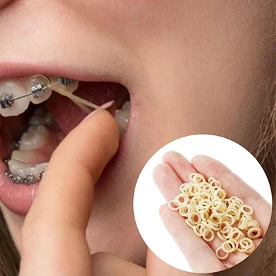 Orthodontic Elastic Rubber Bands Orthodontic Elastic Rubber Bands